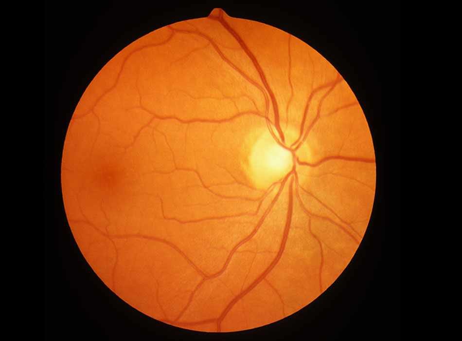 OCT Retina Scan at Benjamin Opticians