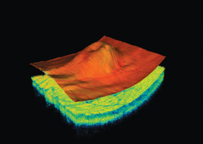 Benjamin Opticians - 3D OCT Eye Scan