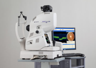 Benjamin Opticians - 3D OCT Eye Scanner
