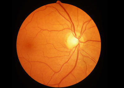 Benjamin Opticians Skipton - OCT Retina Scan